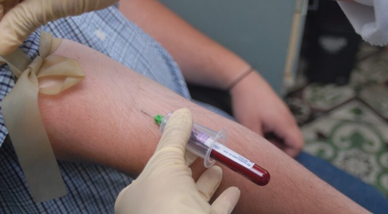 Cuatro marcadores en la sangre ayudarían a identificar a las personas con riesgo de cáncer gástrico