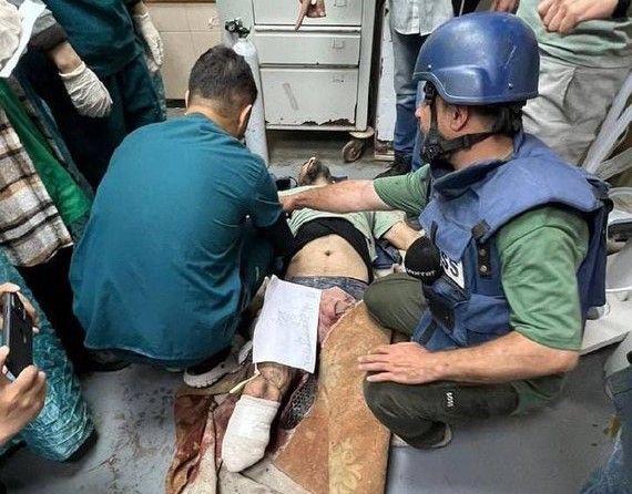Un camarógrafo de la cadena turca TRT pierde una pierna por ataque de Israel en Gaza